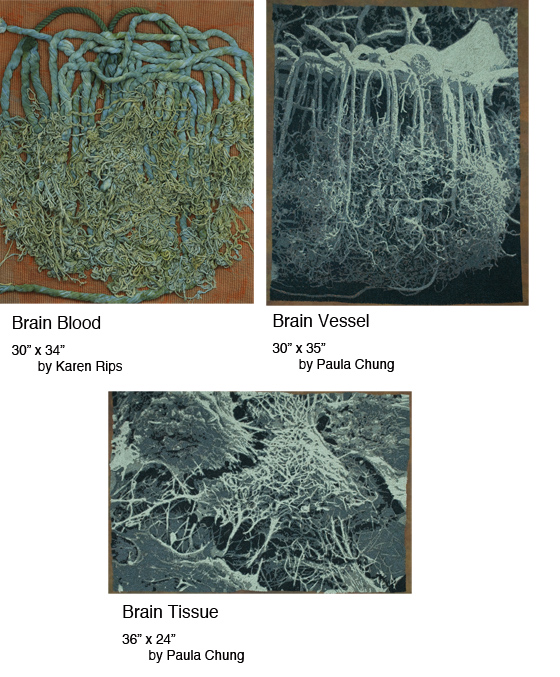 Blood & Brain