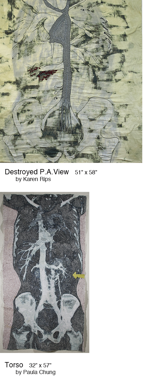 Destroyed P.A. View/Torso
