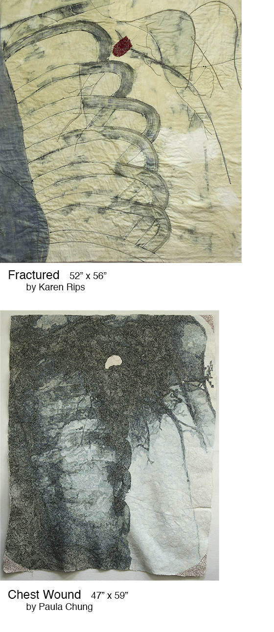 Fractured/Chest Wound